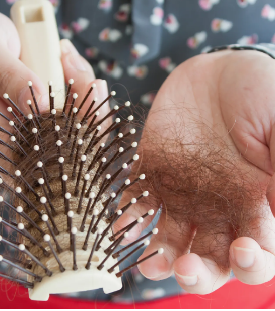 Post Natal Hair Loss