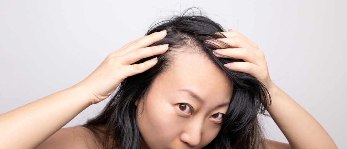 hair-loss-clinic-Singapore-1000x667