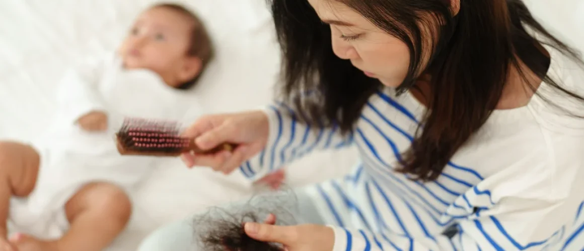 Understanding the Correlation Between Stress and Female Hair Loss