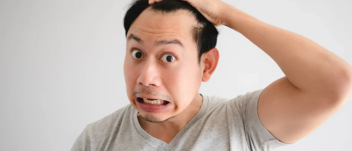 Understanding the 7 Stages of Baldness: A Roadmap to Hair Loss in Males