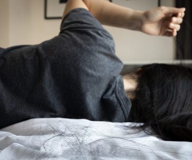 Will Hair Loss Due to Anaemia Grow Back? Understanding the Connection and Treatment