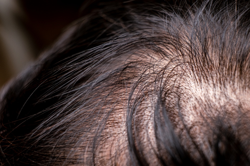 Other Post-Procedure Side Effects to Anticipate