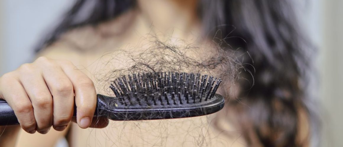 Female hairloss problems